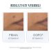 Eucerin DermoPurifyer Oil Control - Siero Tripla Azione Anti Macchie, 40ml