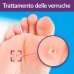 Excilor Warts Duo Power Penna Cryo + Penna Acid Excilor Warts Duo Power Penna Cryo + Penna Acid