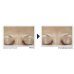 RoC, Derm Correxion Fill + Treat Siero, 15 ml 
