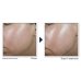 RoC, Derm Correxion Crema Viso, 50 ml
