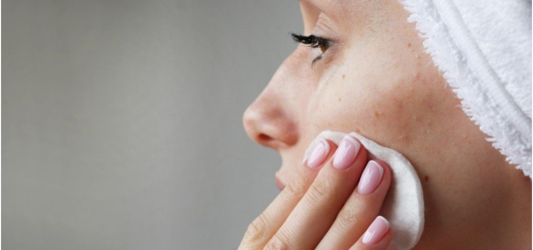 SOS acne in età adulta: quali sono le cause e come intervenire?
