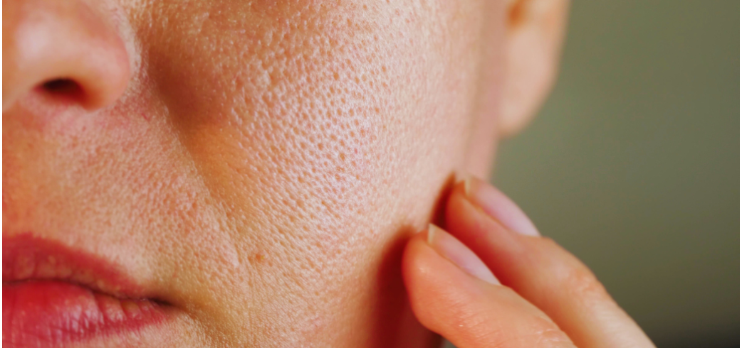 Come ridurre i pori dilatati con i migliori prodotti per il viso