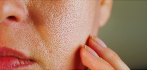 Come ridurre i pori dilatati con i migliori prodotti per il viso