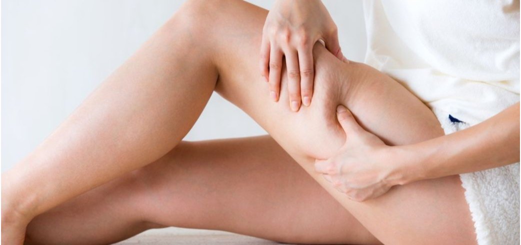 Che differenza c'è tra cellulite e ritenzione idrica? Cause e rimedi efficaci