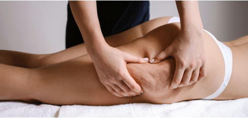 Perché viene la cellulite e come contrastarla con creme e drenanti